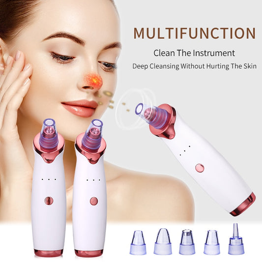 Advanced 3-Speed Intelligent Pore Vacuum - 5-in-1 USB Rechargeable Blackhead, Sebum & Impurity Suction Beauty Instrument