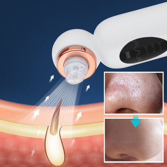 Advanced Small Bubble Blackhead Remover - 6-in-1 Electric Hydro Facial Pore Vacuum & Deep Impurity Cleansing Instrument