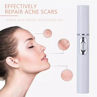Advanced 415nm Blue Light Photon Therapy Pen – BIO Microcurrent Pore Refiner & Skin Calming Device