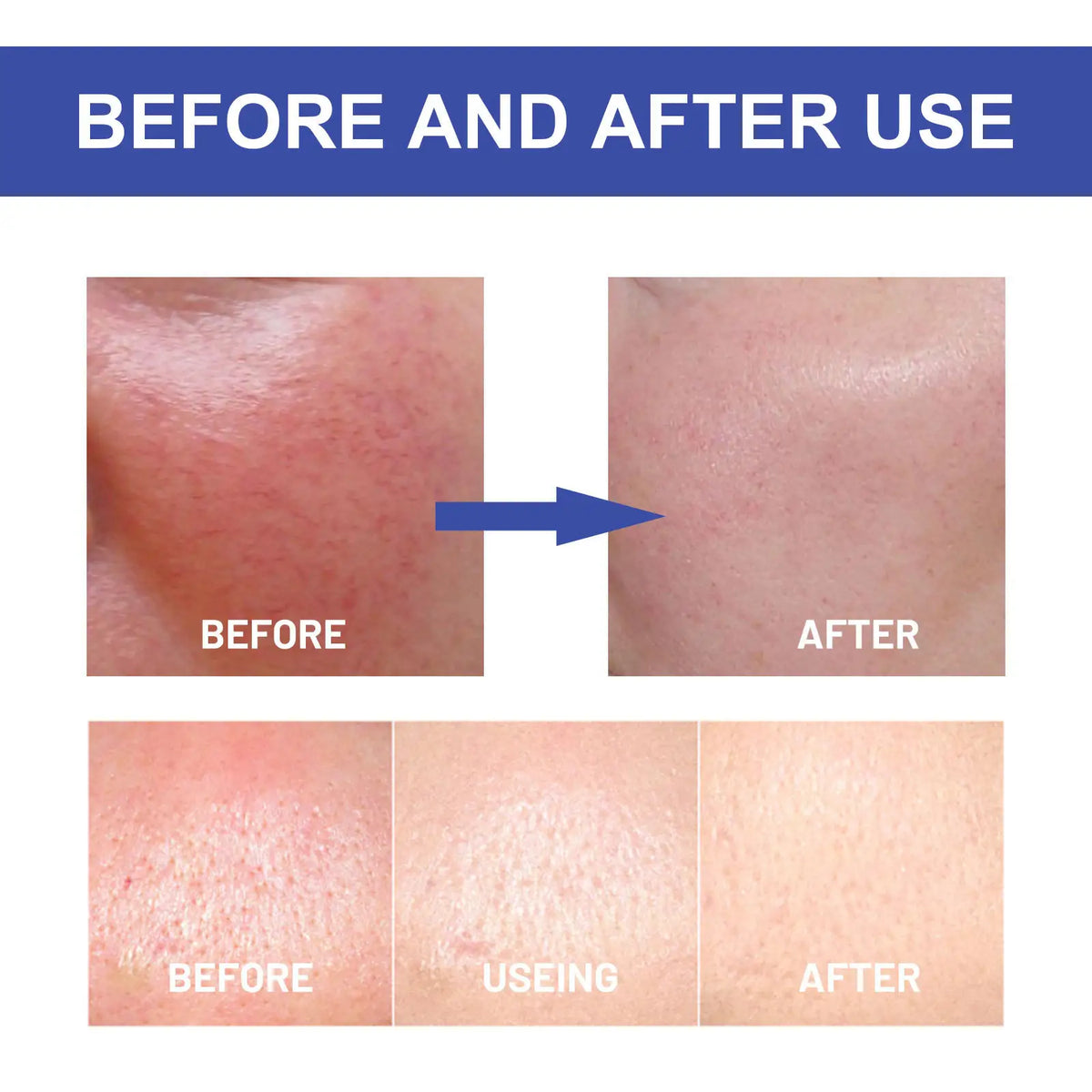 HOYGI Hyaluronic Acid UVA/UVB Strong Protection Liquid Sun Gel SPF50+ PA++++, 50g