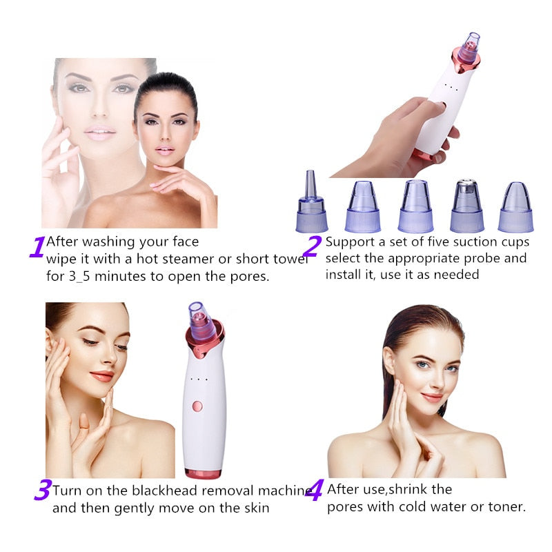 Advanced 3-Speed Intelligent Pore Vacuum - 5-in-1 USB Rechargeable Blackhead, Sebum & Impurity Suction Beauty Instrument