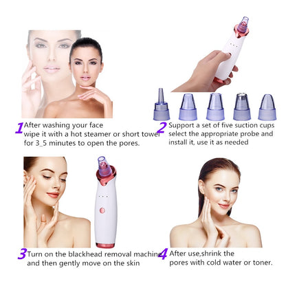Advanced 3-Speed Intelligent Pore Vacuum - 5-in-1 USB Rechargeable Blackhead, Sebum & Impurity Suction Beauty Instrument